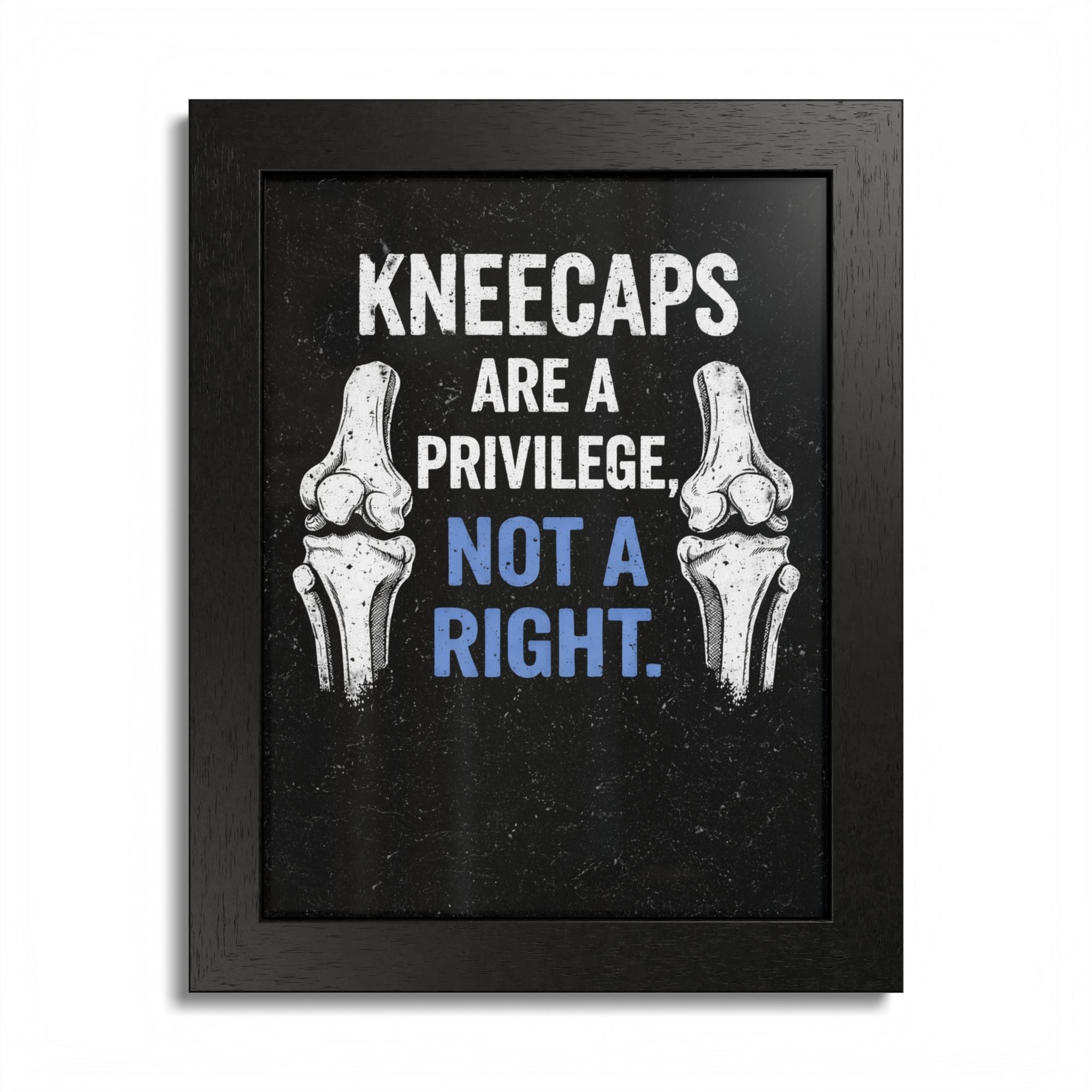 "Kneecaps Are a Privilege, Not a Right" Framed Poster